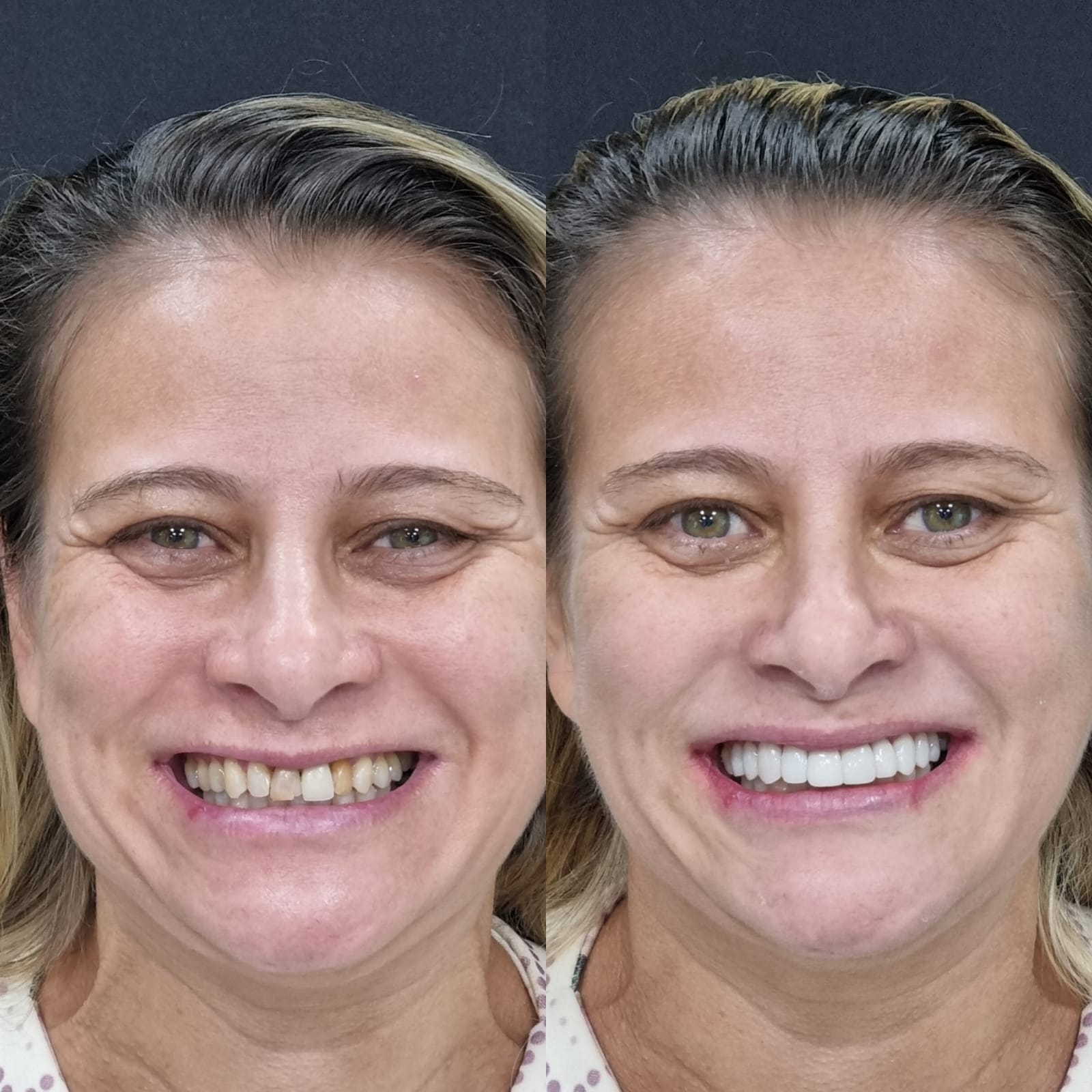 Antes e depois — transformação completa